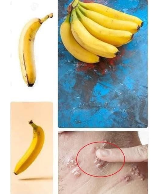 Did you know that if you eat BANANA EVERY DAY your body can… See more in first comment