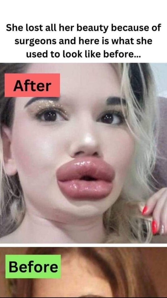 She lost all her beauty because of surgeons and here is what she used to look like before…