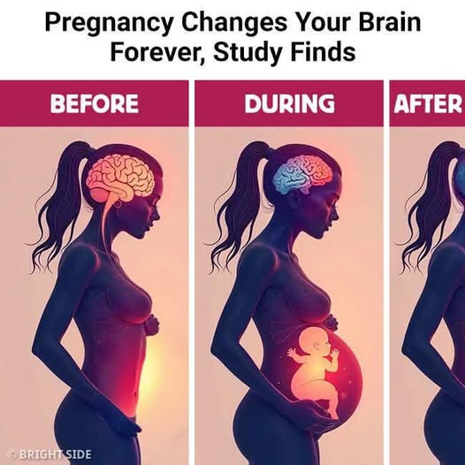 Pregnancy Changes Your Brain Forever, Study Finds