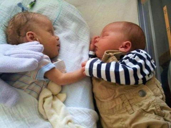 Mom could hardly wait to give birth – When the TWINS were born, she was informed that one of them was dying!