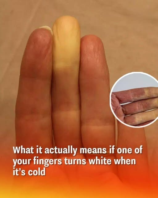 I had NO idea 👇😨