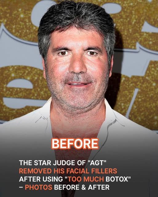 “AGT” judge Simon Cowell ditched his facial fillers after hardly recognizing himself—check out his dramatic before and after photos